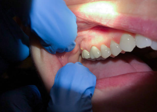 Best Broken or Cracked Tooth Emergency Dentist in Hillsdale, NJ